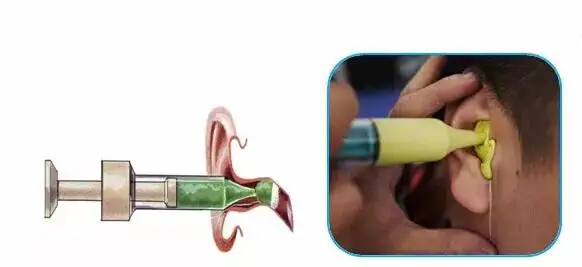 2023 new product Eear Impression material silicone impression material to make hearing-aid impression