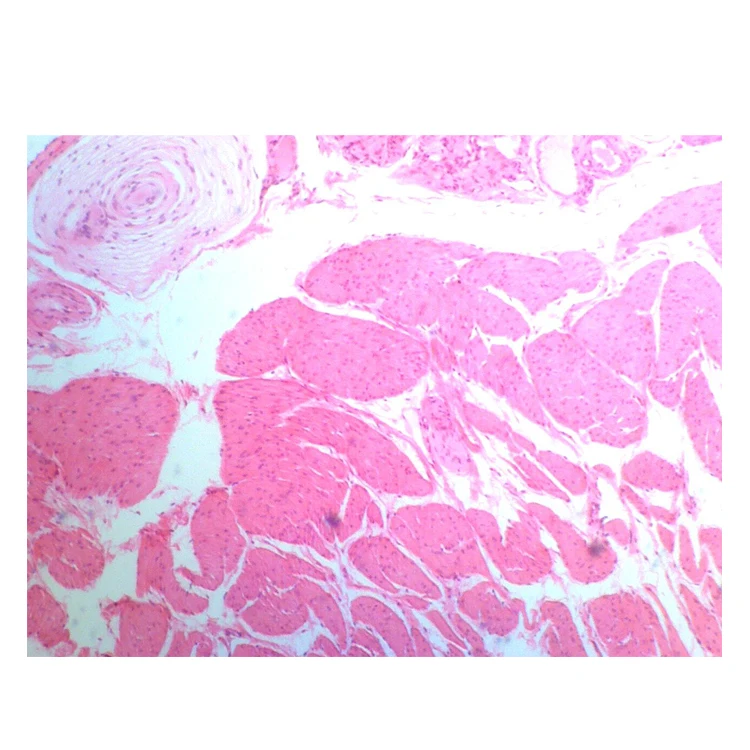 School and Medical Hot Sale Human Chromosome microscope prepared slides