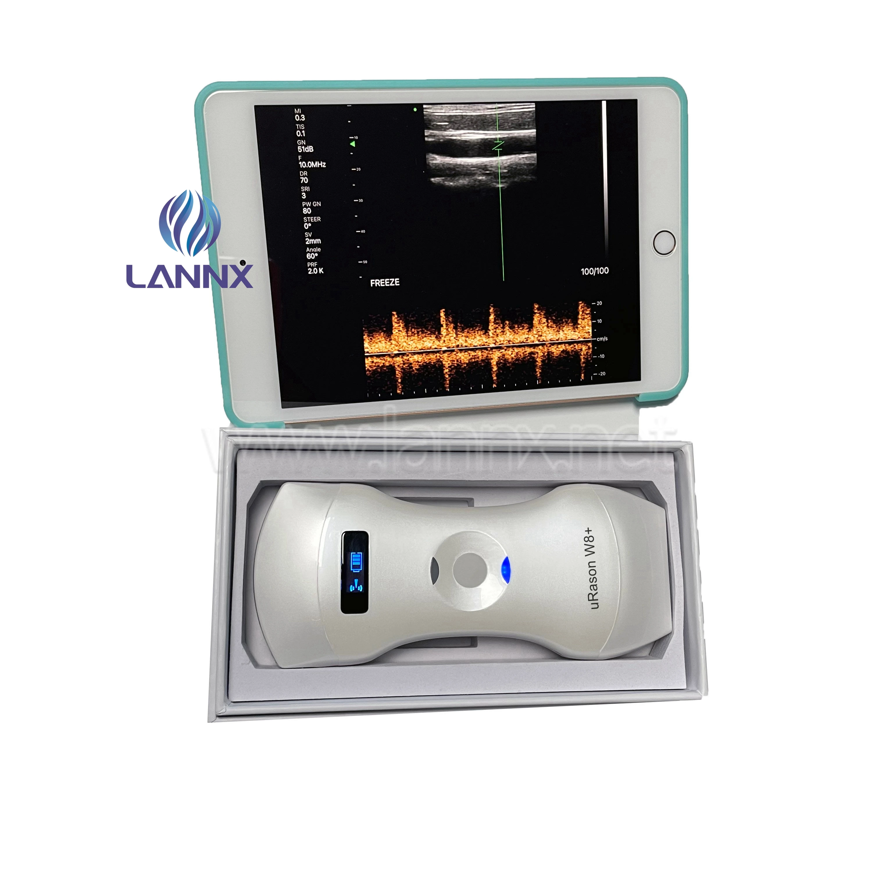 Ручной двухголовый ультразвуковой зонд LANNX uRason W8 + выпуклая линейная Фаза 3 в 1 беспроводной портативный Wi-Fi
