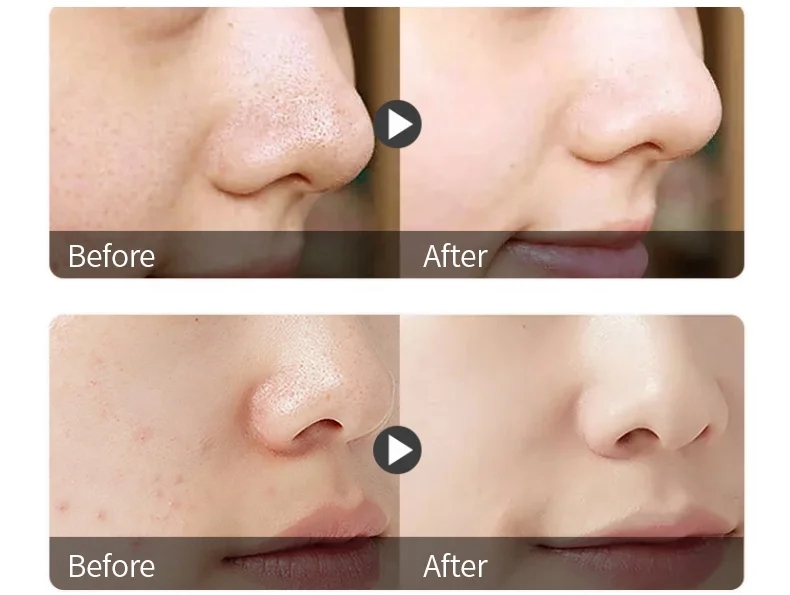 Customized Private Label Blackhead Remove Nose Strip Skin Care Deep Cleansing Shrink Pores Pore Clean Nose Strips