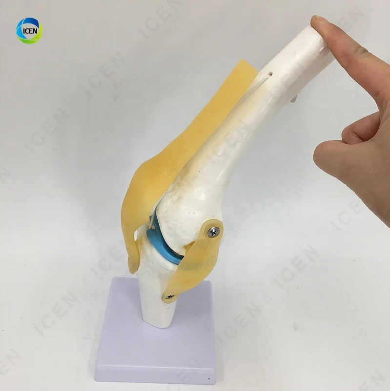 IN-M15 Plastic Elbow Joint With Ligaments,Model Of Human Knee Joint,Elbow Joint Skeleton Model