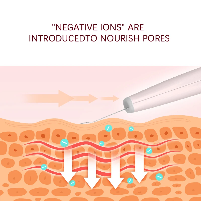 KSKIN 2022 Best selling Facial Pore Deep Cleaner electric cleaning ultrasonic portable skin scrubber