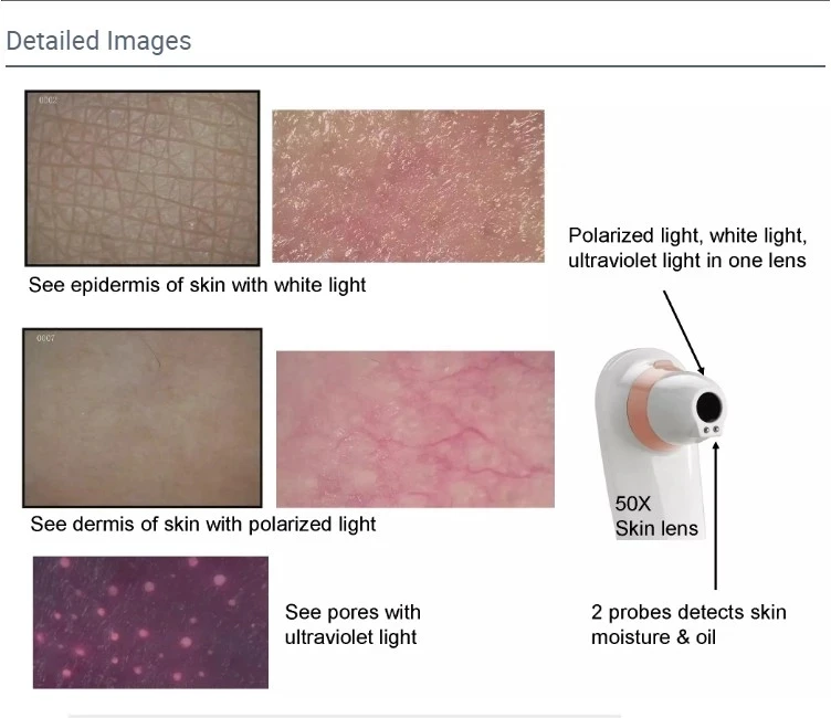 Portable HD Hair Follicles Scalp Scanner Detector Hair Analyzer  Skin And Scalp Hair Analysis Machine