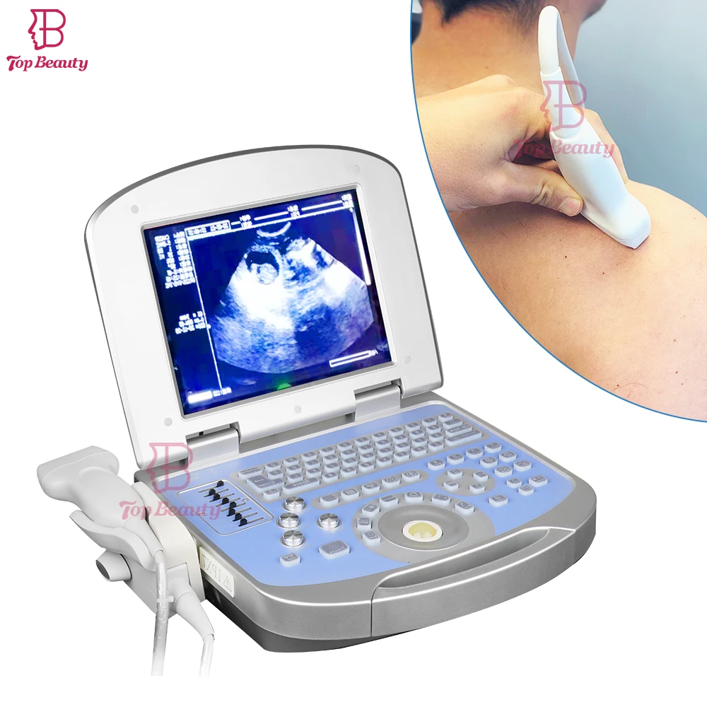 Portable Site-rite Ultrasound Scan 3D 4D Full Digital Medical Ultrasonido Portatil Hospital Diagnostic Laptop Machine