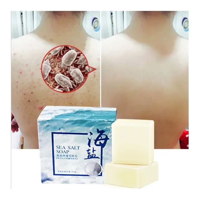 goat milk soap base  Removing mites