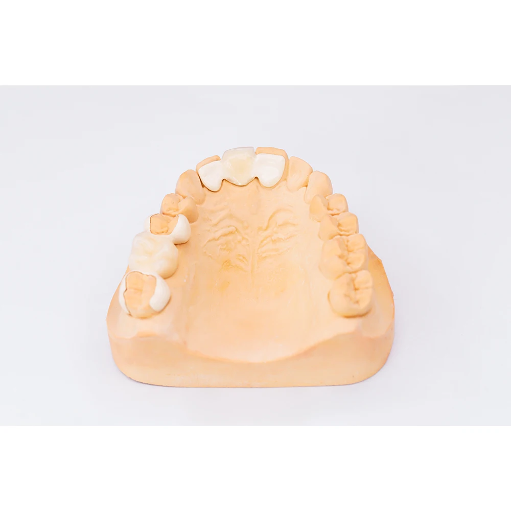 dental laboratory denture teeth fixed crown artificial tooth PEEK Composite Crown for dental clinic