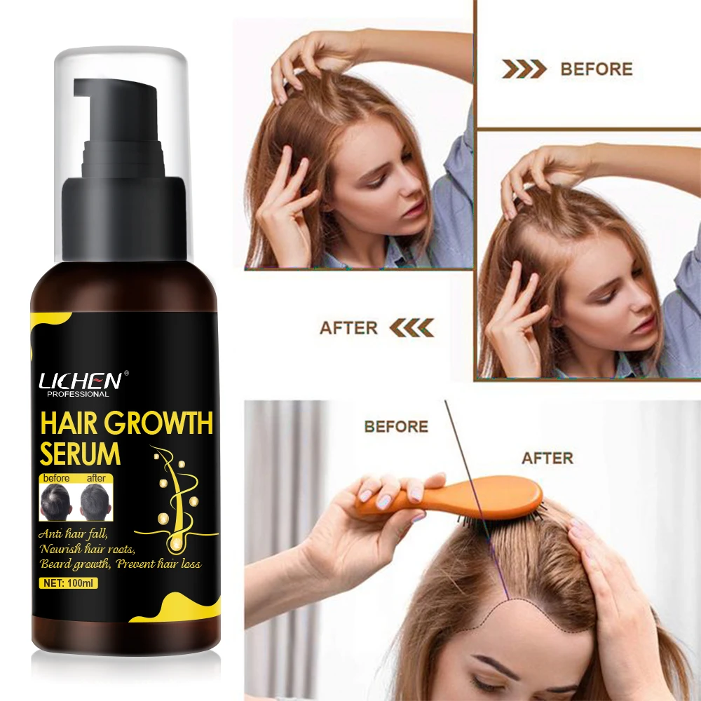 Лучший результат, сыворотки для быстрого роста волос ginger, Органическая натуральная формула, оптовая продажа для афроамериканских волос