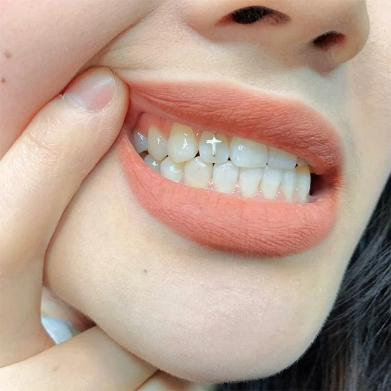 18k Gold other teeth whitening accessories led kit machine strips teeth price whitening gel tooth Fine jewelry earrings bracelet