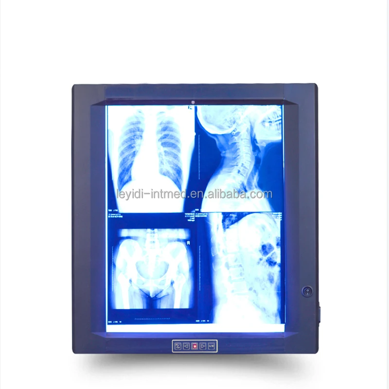 Quad Bank Radiaography Led X Ray Medical Negatoscope Film Viewer