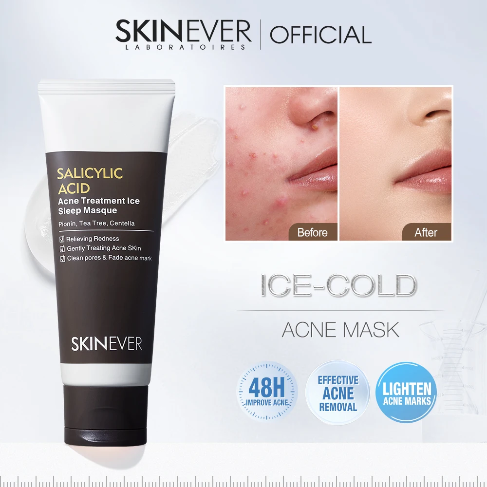 SKINEVER Salicylic Acid Ice Sleep Masque Cream Acne Treatment Face Body Mask Crystal Cleans Pores Fades Acne Marks Relieves