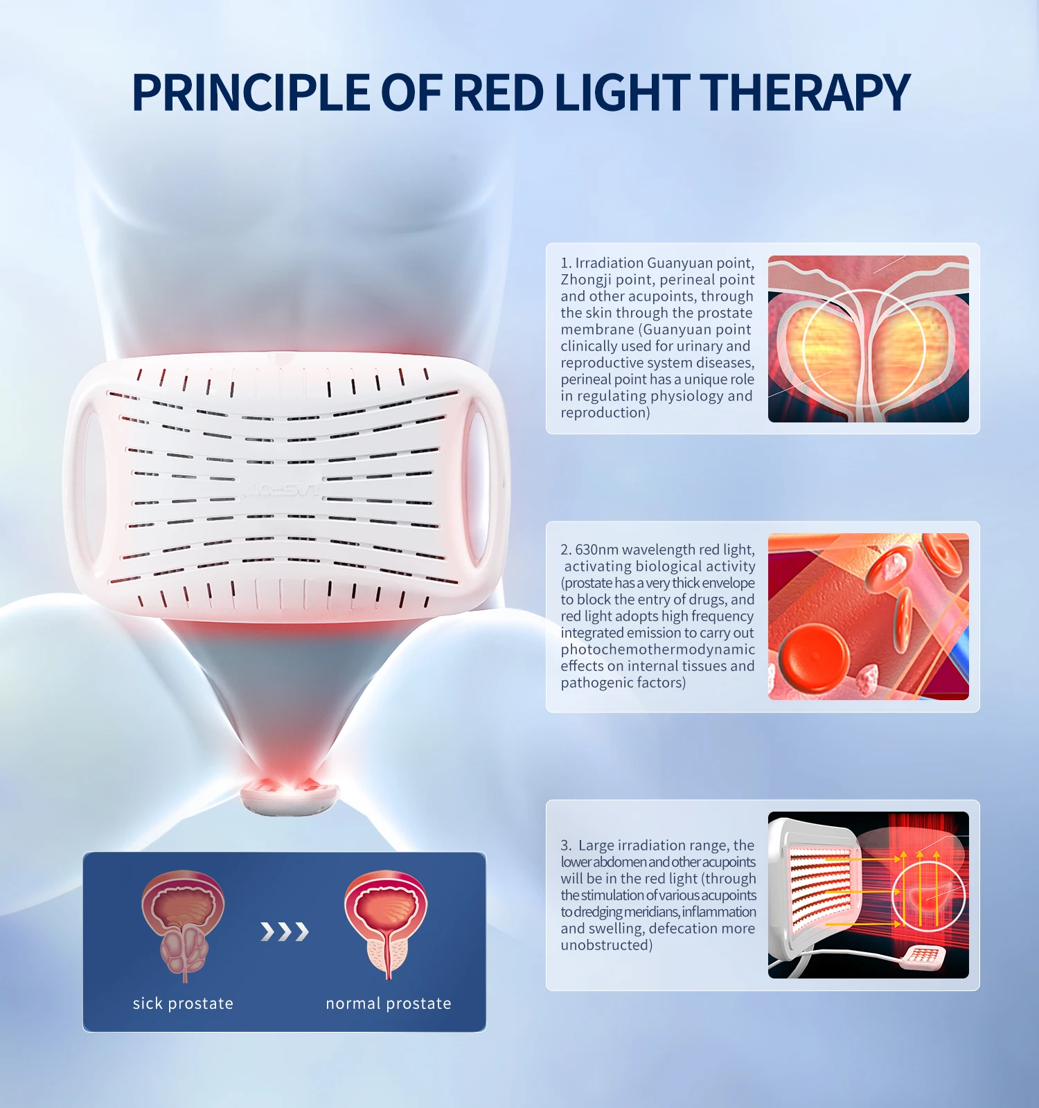 High-intensity Red Light Therapy Instrument Prostatitis Premature Ejaculation Impotence Treatment