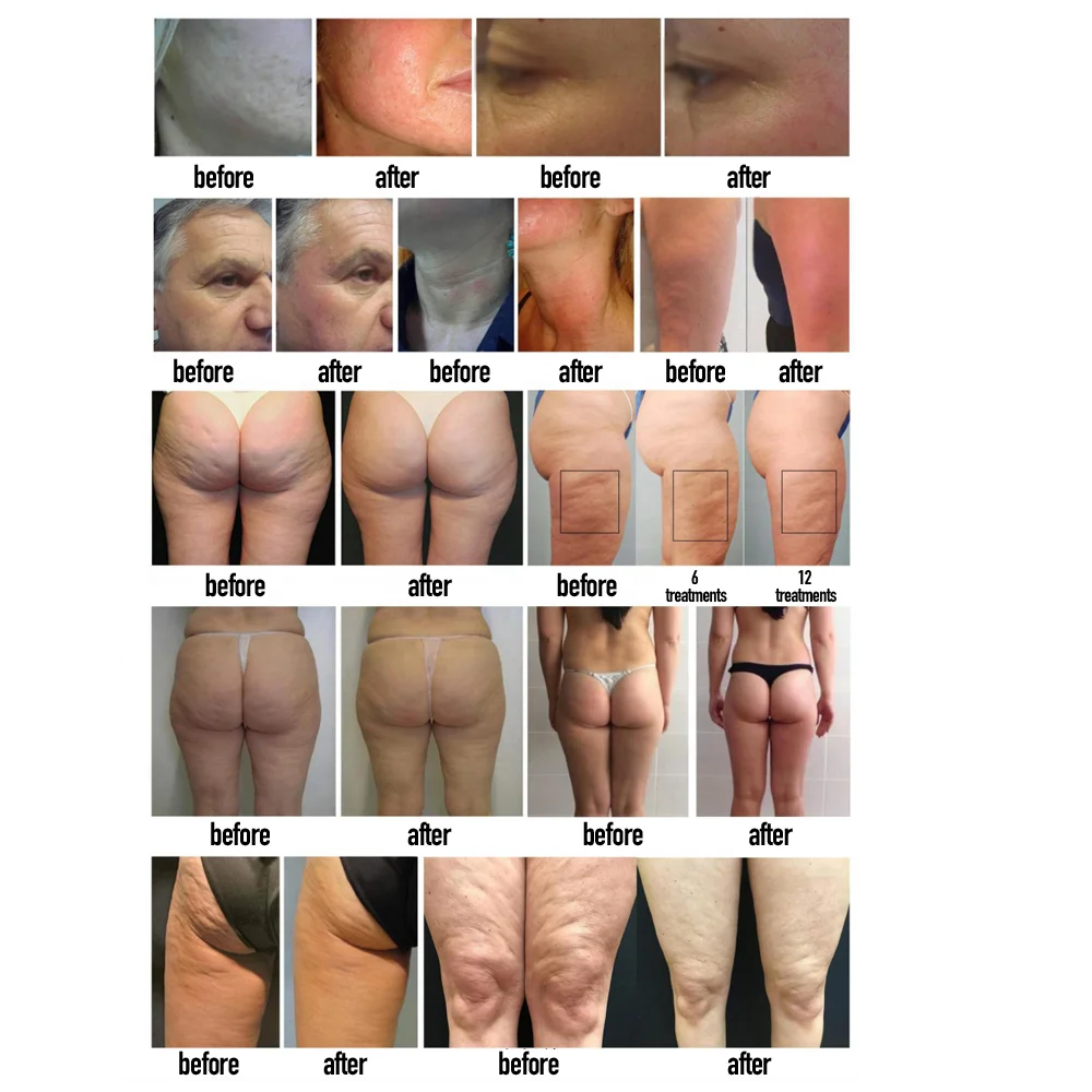 2022 Newest Fat Removal Inner Ball Roller Massage Cellulite Removal Body Shape Sculpting Vacuum Cavitation Slimming Machine