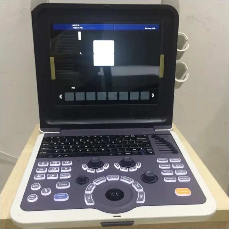 4D Full Digital Color Doppler Ultrasound Diagnostic System Competitive Price 6 Languages Portable Ultrasound