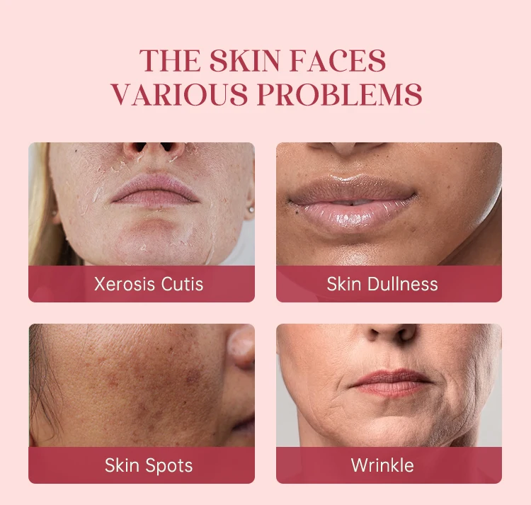 Customizable 5 In 1 Skin Care Serum Face Serum Hyaluronic Acid 10% Facial Niacinamide 5% Whitening Collagen 5% Vitamin C 30%