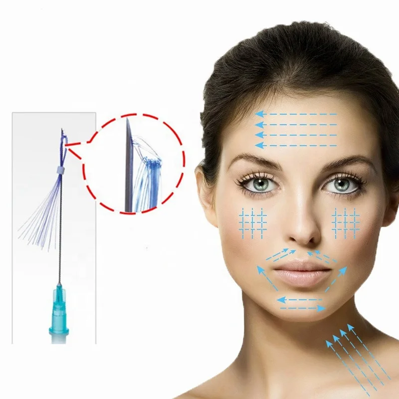 Hot sale korea PDO thread lift multi pdo thread