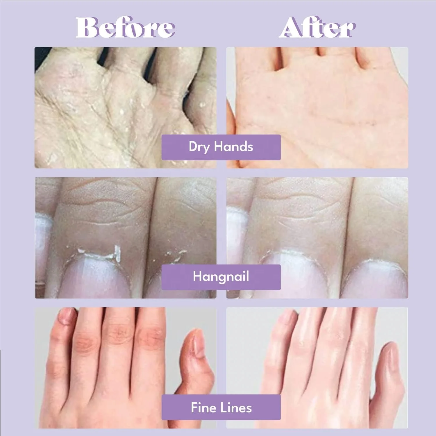 Moisturizing Gloves with CICA, Whitening Repairing and Nourishing Hand Care Treatment Hand Mask for Cracked, Rough, and Dry Skin