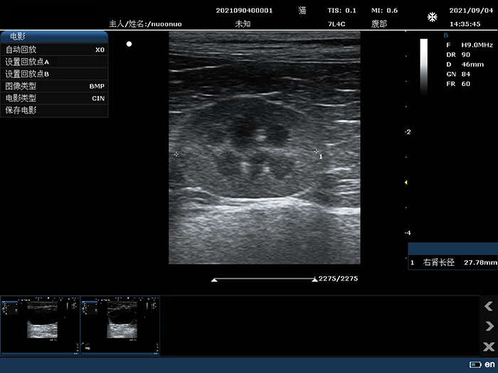 C10B Color Doppler Ultrasound Machine Portable Device