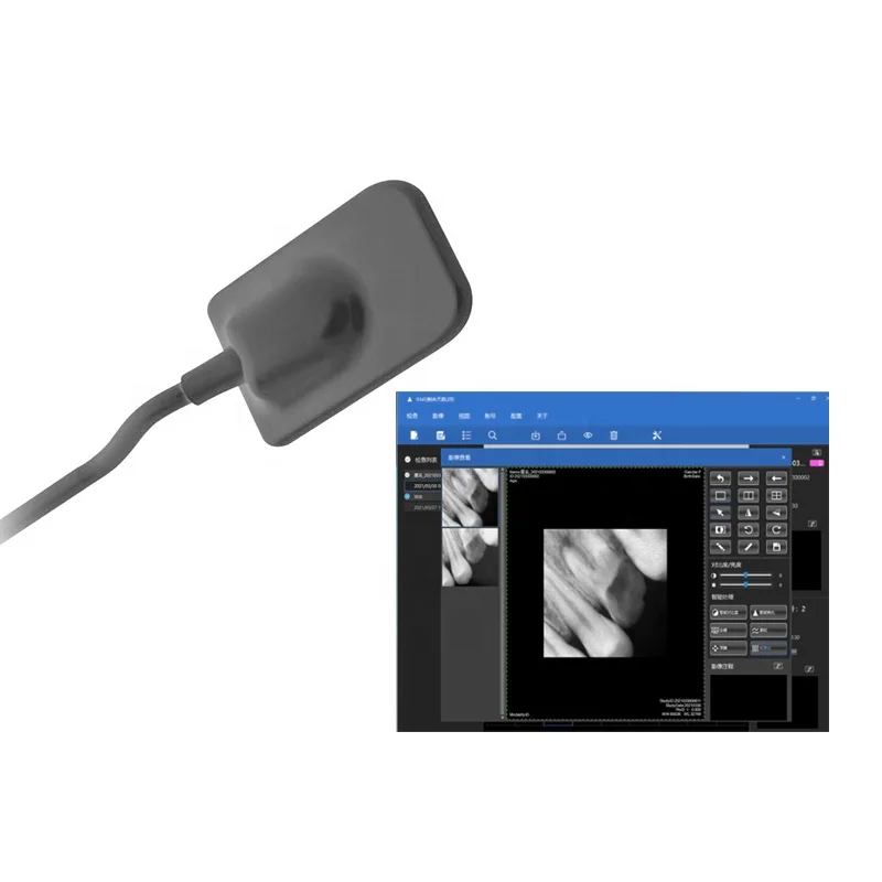 Intraoral X ray Imaging Sensor Dental Digital For Clinical dentistry Xray dental radiography sensor