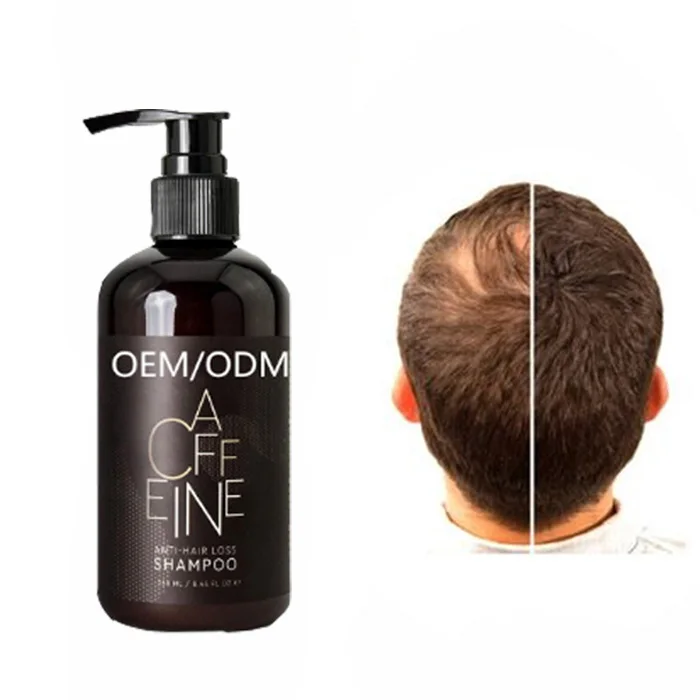 Private label Hair growth shampoo prevent hair loss deeply plant mild shampoo