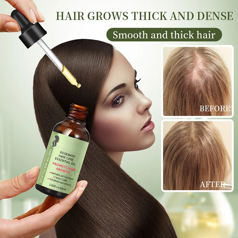 100% Pure Organic Rosemary Oil Nourishes Scalp Improves Blood Circulation Rid of Itchy & Dry Scalp Hair Care Oil 60ml