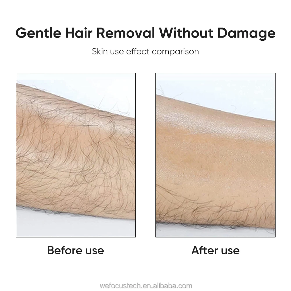 Crystal Hair Removal  (12).jpg