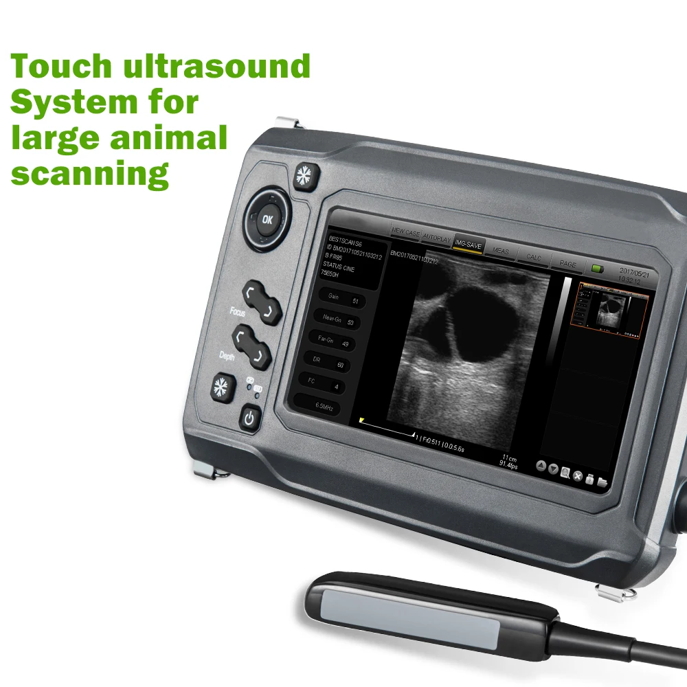 Electric Medical Ultrasound Instruments portable wifi ultrasound probe veterinary medical ultrasound machine