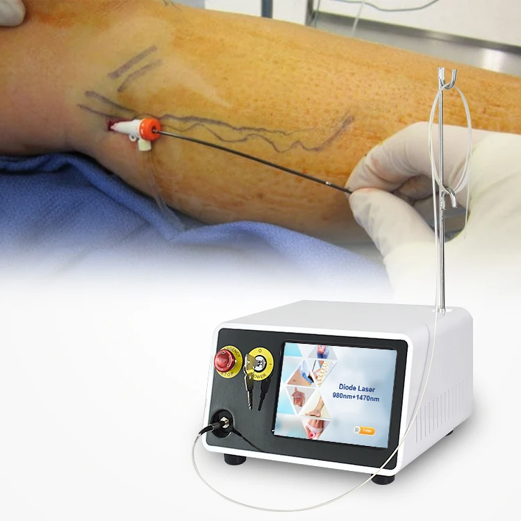 TRIANGEL 980 1470nm Endovenous Laser Varicose Veins Therapy EVLT Endovascular Laser Ablation Clinic Device