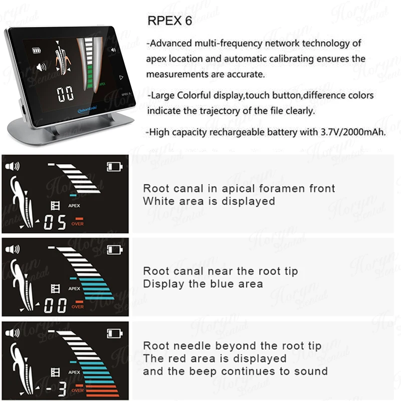 Dental Apex Locator Golden Or Rose Golden Color With Multi-functions