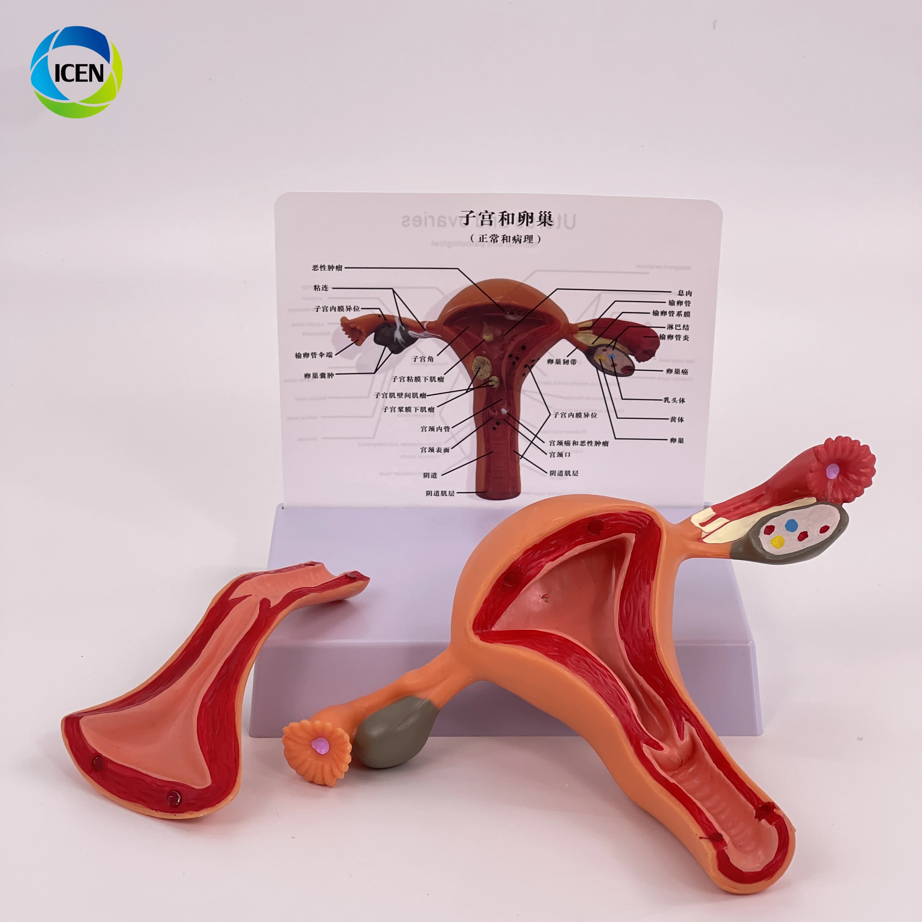IN-M2 Medical Science Magnified Human Anatomical Model Normal Educational Models Human Anatomy Uterus Model