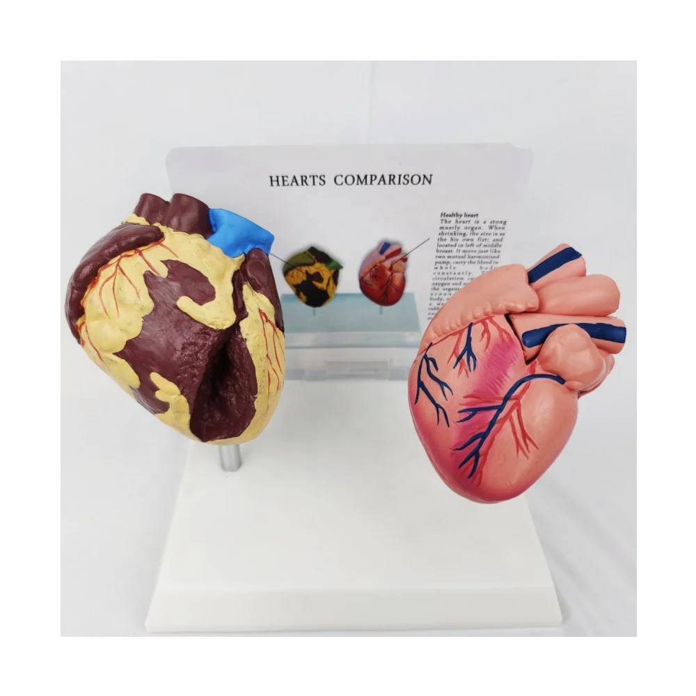 Medical Sciences Comparison  Human Heart Pathology Model  Organ Disease Model Anti Drug Model