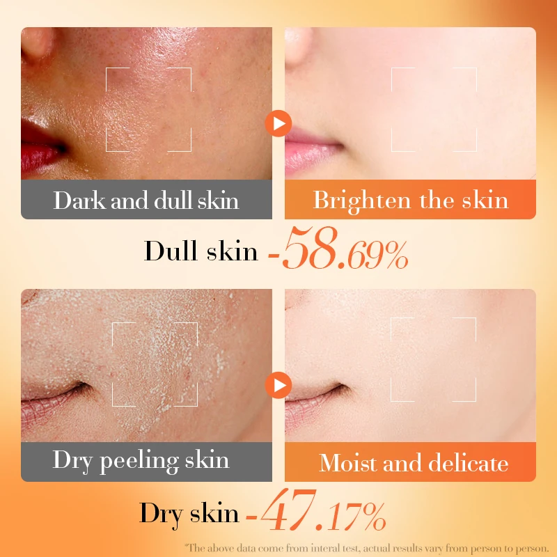 BIOAQUA Beauty Vitamin E Product Set Whitening Anti Aging Facial Skincare Toner Lotion Face Cream Serum Cosmetic Skin Care Kit