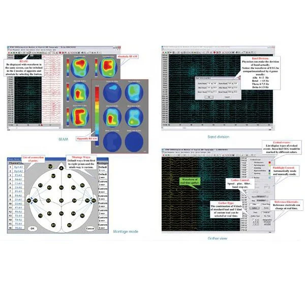
EEG-1018 High Quality 16 Channels Digital EEG System 
