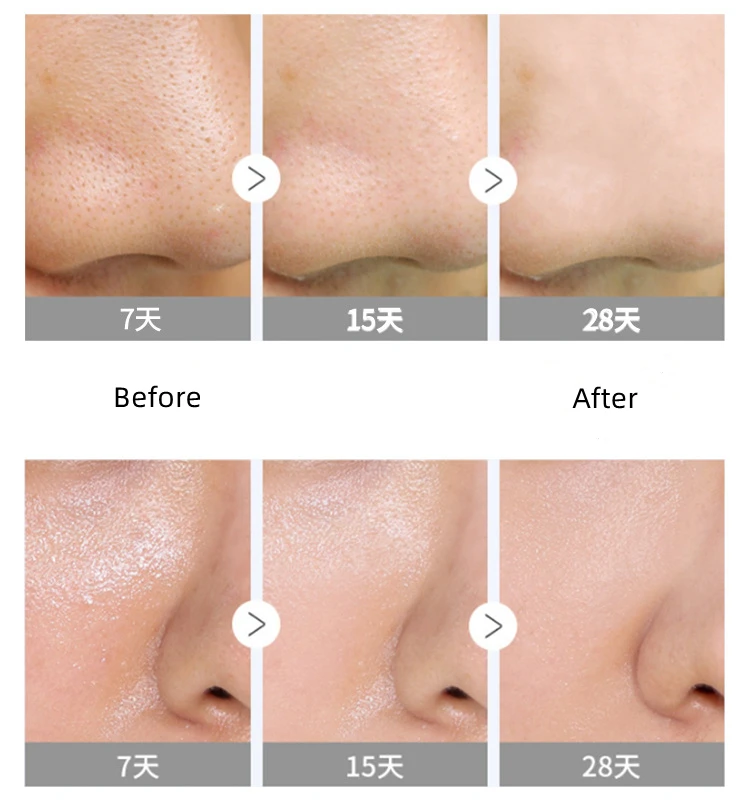 Natural organic Handmade Bamboo Charcoal Soap Skin care Deep Cleansing oil-control face Soap For Men