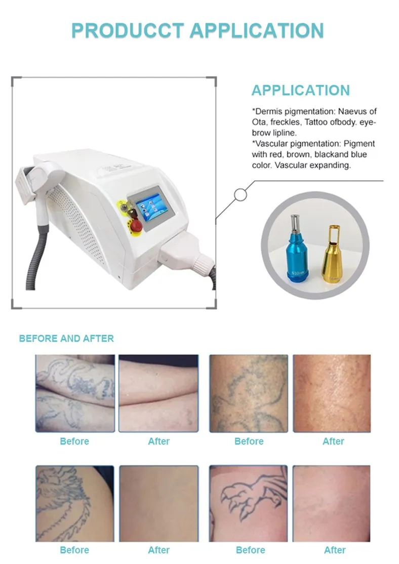 Самая современная технология, лидер продаж, аппарат для красоты nd yag, мини-татуировка, Овальный лазер, заводская цена