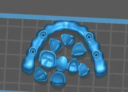 3D-принтер DLP сверху 2K для стоматологических украшений керамический шламовый глинозем цирконий без поддержки
