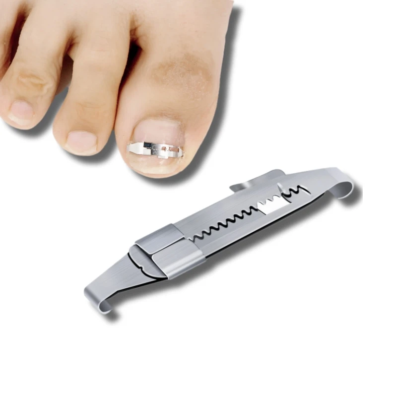 Free samples Toenails Corrector Nail Care Tool Straightening Clip Curved Brace Toenails Thick Paronychia Correction Foot Care