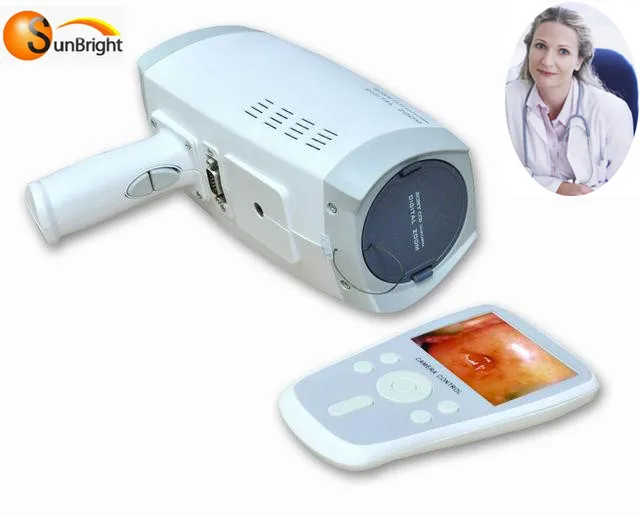 best price colposcopy machine digital video colposcope