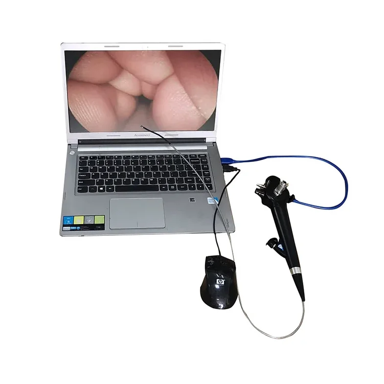 Portable  endoscopic USB video gastroscope light source digital endoscope duodenoscope
