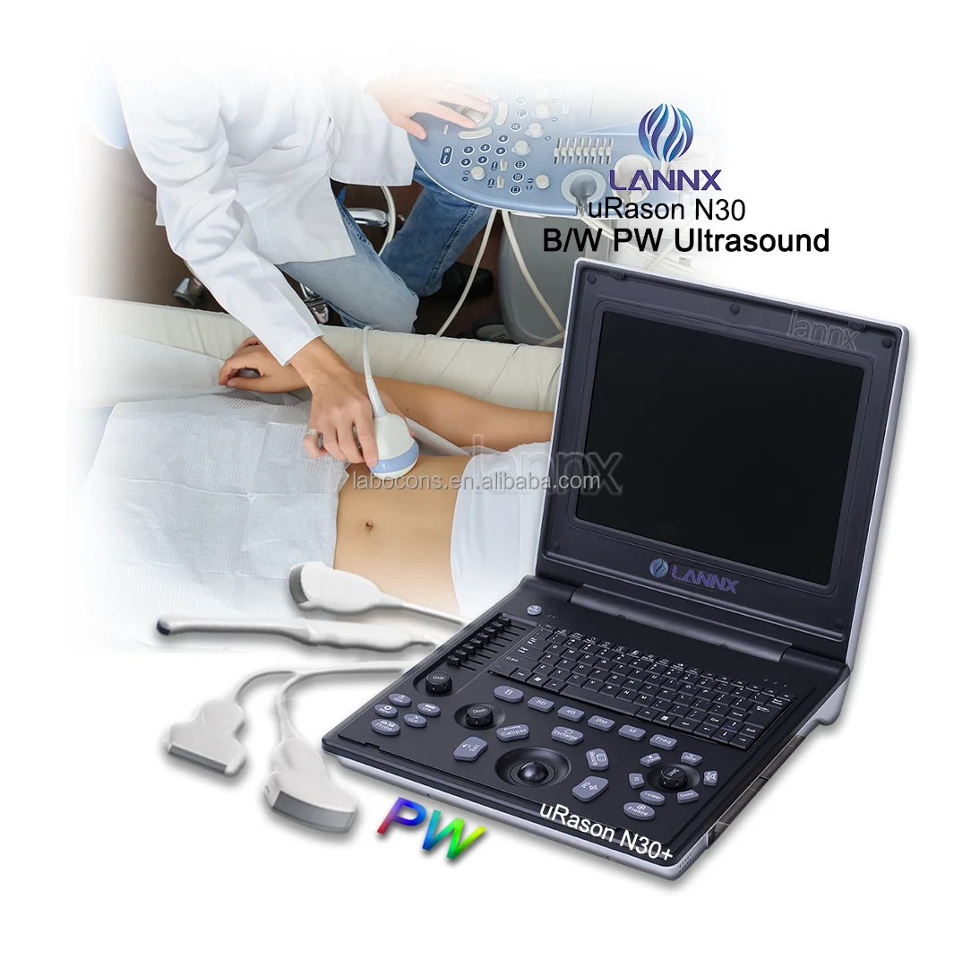 LANNX uRason N30+ Wholesale ultrasound Diagsostic System Cardiac OB GYN B/W PW Echocardiography Portable ultrasonic scanner
