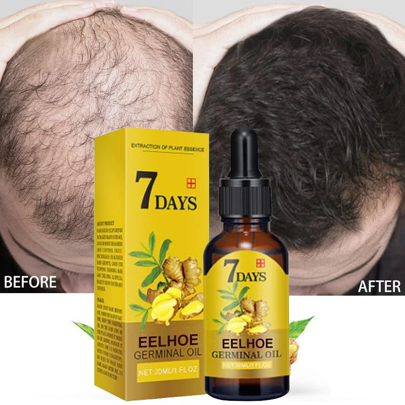 Hot sale 7 days rapid hair growth essence oil hair loss treatment growth hair care essential oil Both men and women