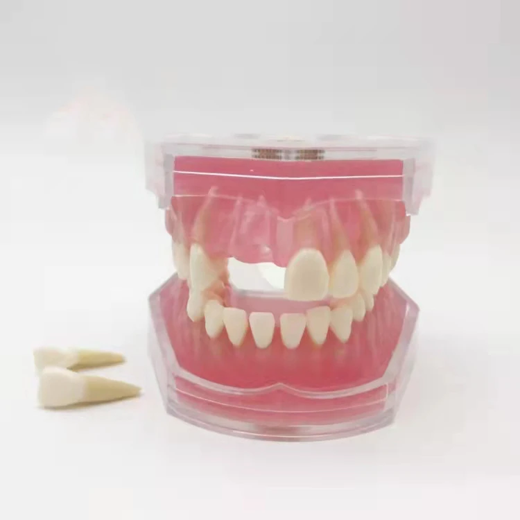 Dental Standard Model Teaching Denture Model Student Doctors Practice Tooth Extraction Model
