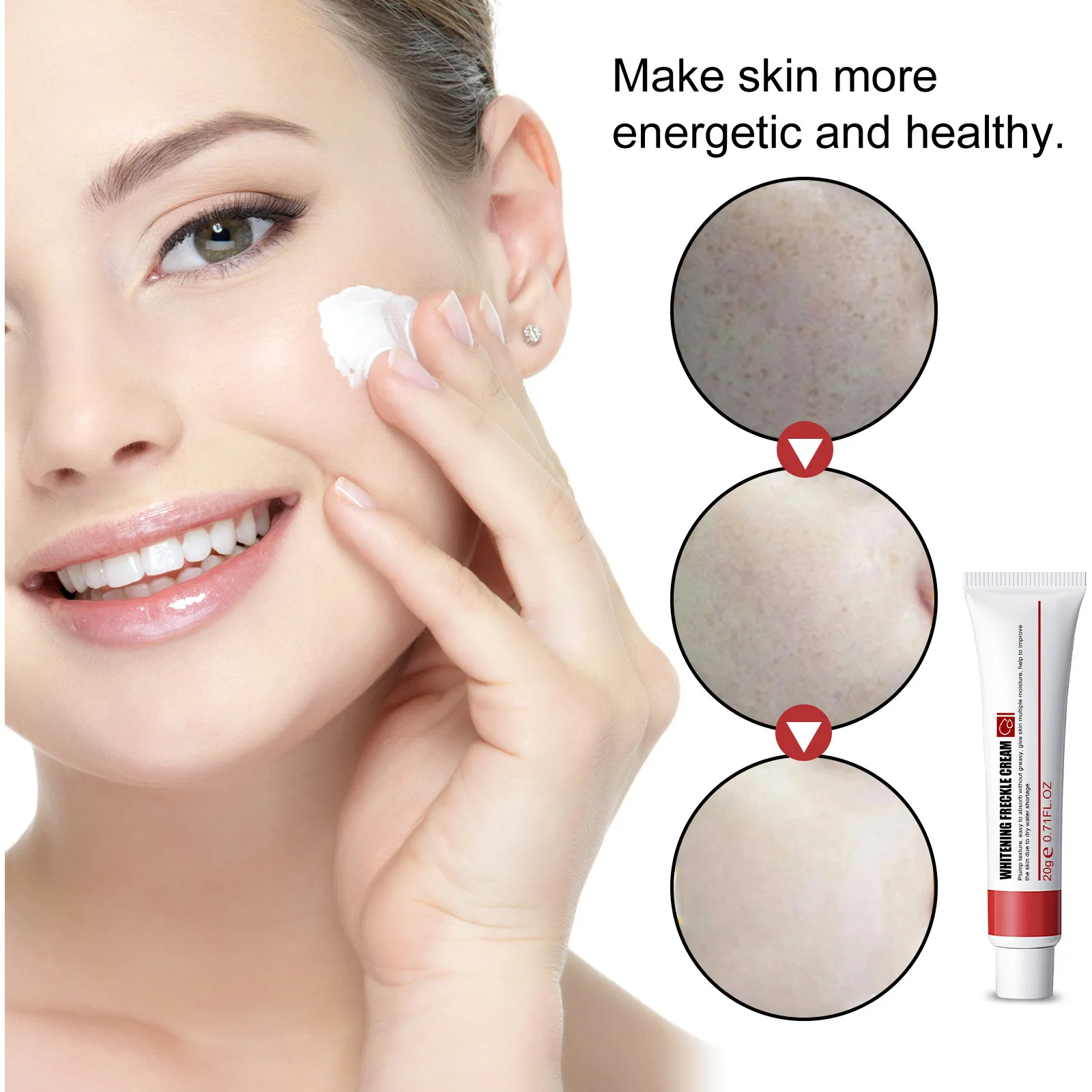 20g Effective Whitening Freckle Cream Remove Acne Dark Spot Fade Pigmentation Melasma Brighten Anti Freckle Cream
