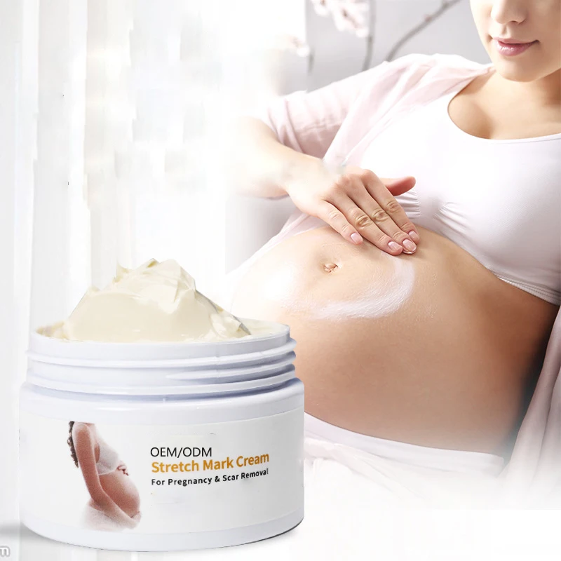 free shipping  stretch marks removal cream all skin stretch mark cream thailand quick and fastest cream for stretch marks