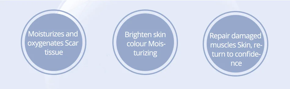 striae gravidarum cream