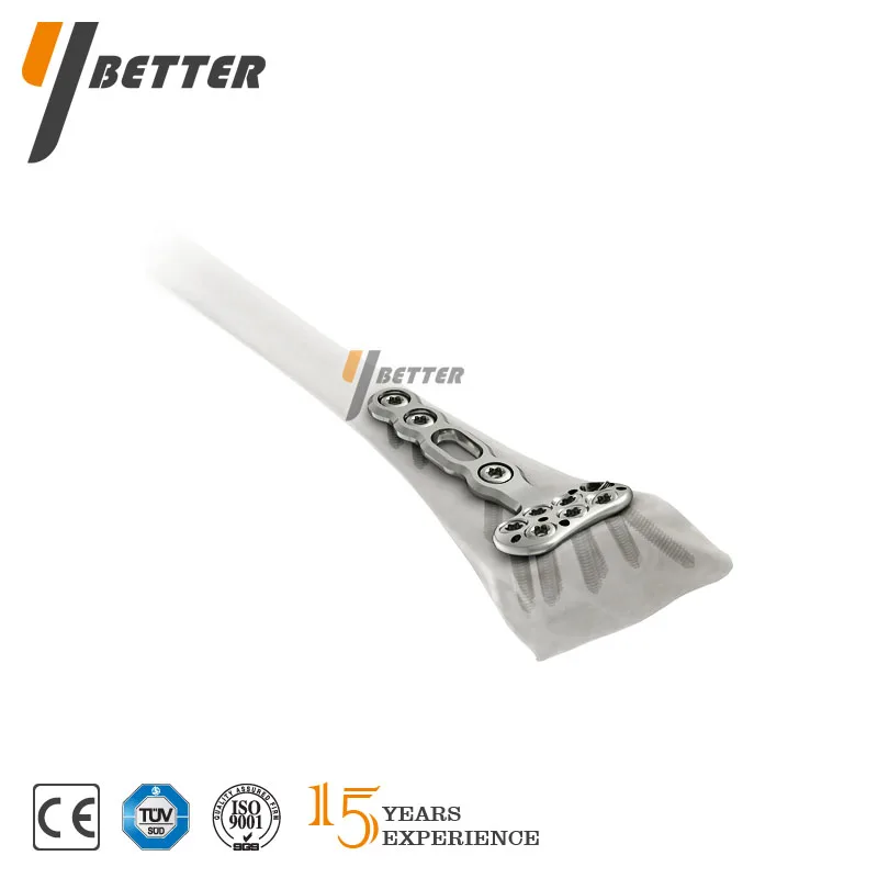 Youbetter Y-DVR Distal Radius Volar Plate Orthopedic Implants Instrument Set