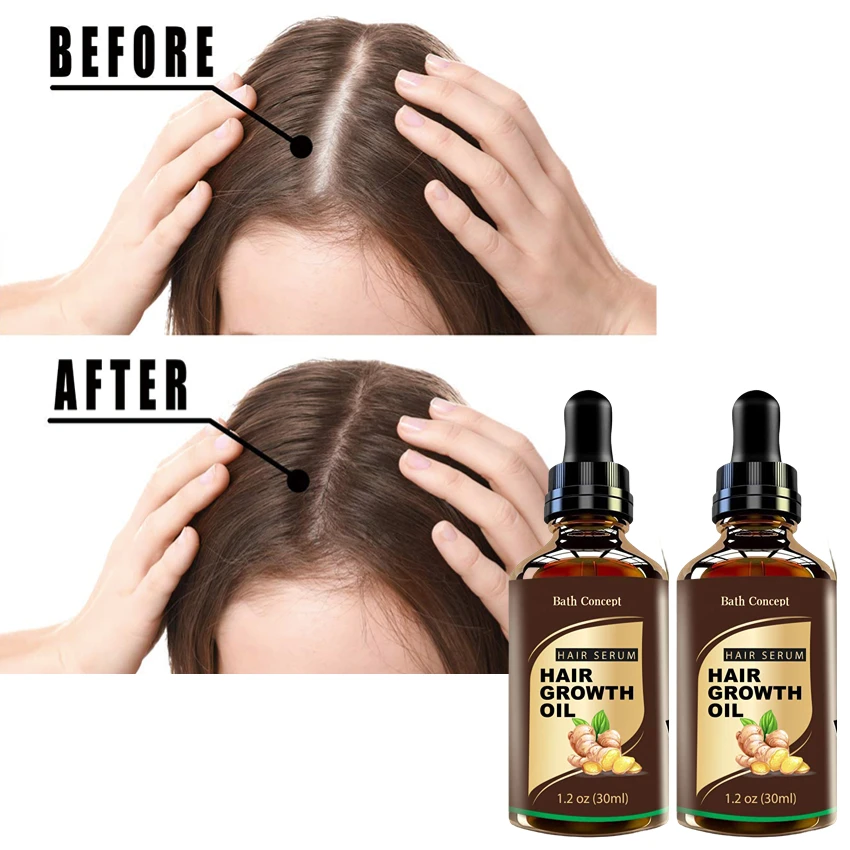 Promotes hair growth oil nourishing thick care ginger hair growing oil hair growth oil for black women private label