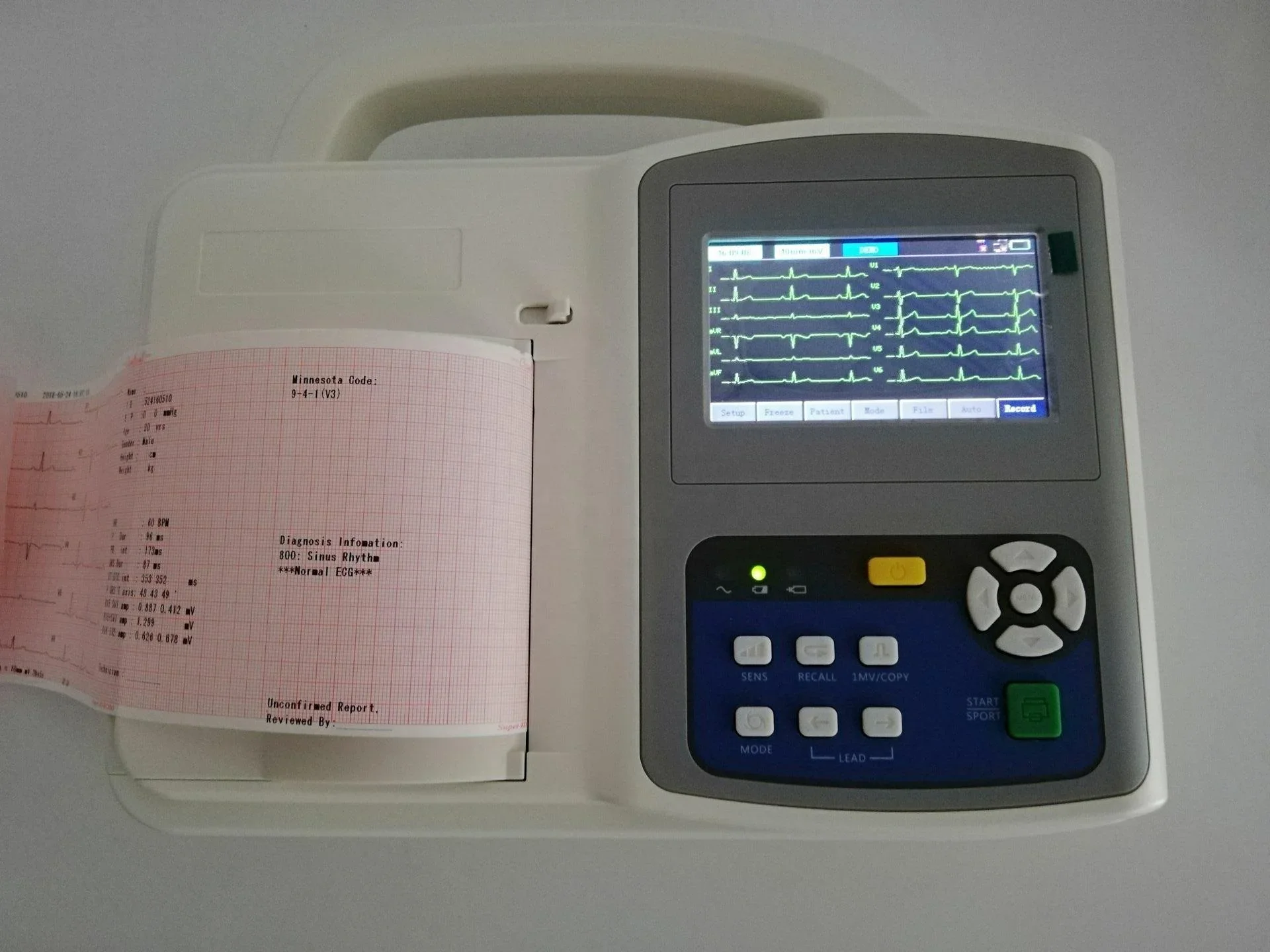 Портативная Диагностика ecg machine на дому