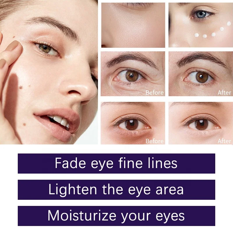 OEM ODM Natural Retinol Eye Cream Dark Circles Reduced Anti Aging Anti Wrinkle Line Smoothing Eye Skin Cream