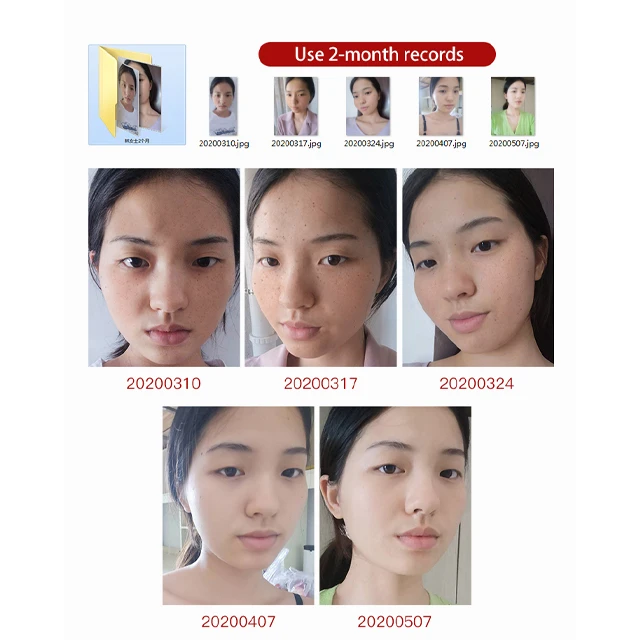 Korea Skincare Full Effect Snail Whitening Miost Nourishing Face Skin Cream In Dubai