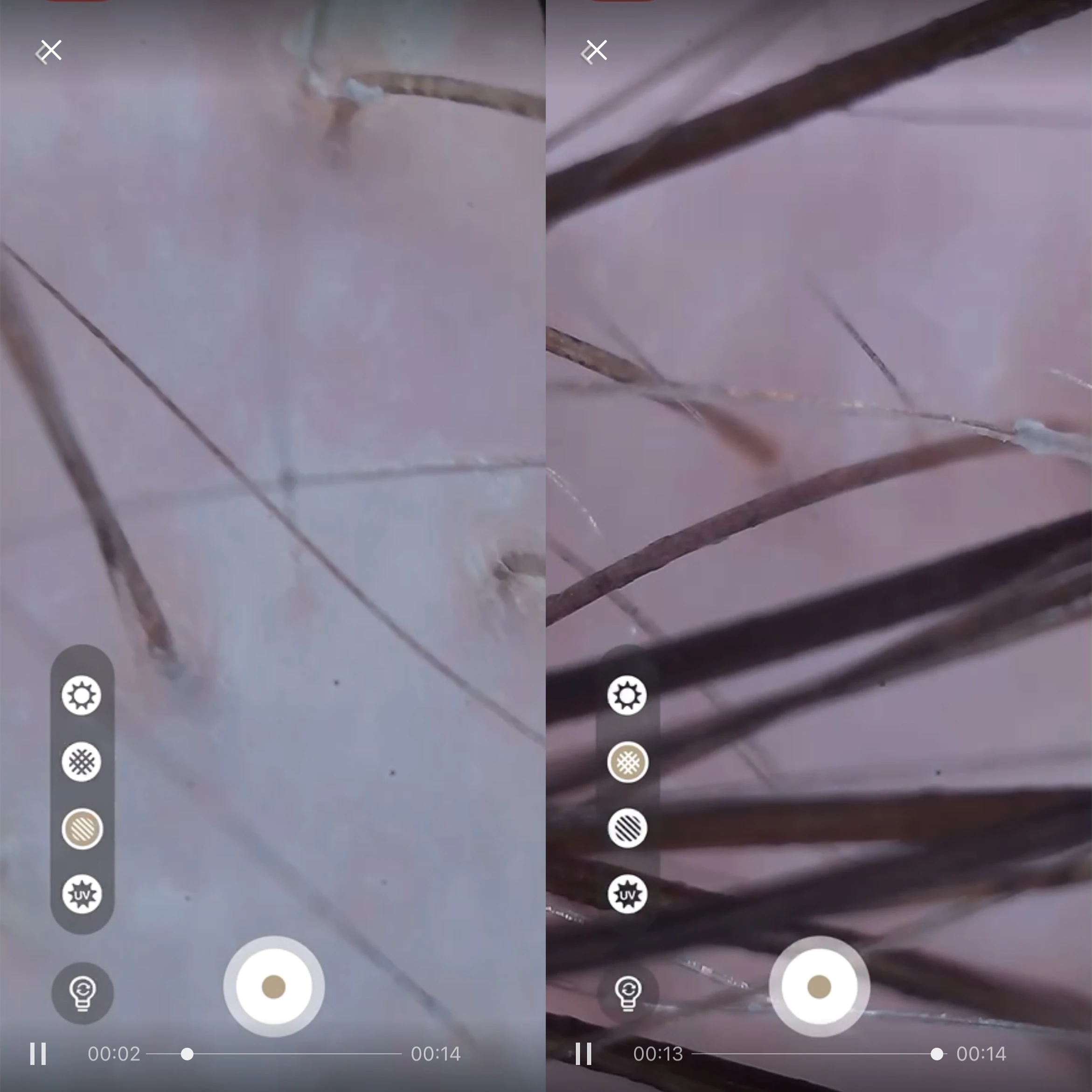 Skin Scalp Hair Tester Pen